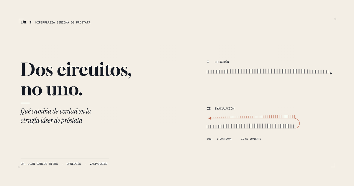 Diagrama editorial: dos circuitos paralelos. El primero, rotulado erección, avanza y continúa. El segundo, rotulado eyaculación, avanza, gira y regresa sobre sí mismo.